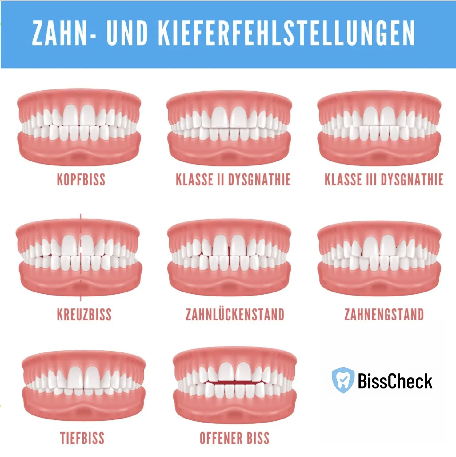 Infografik mit verschiedenen Zahnfehlstellungen: Kopfbiss, Klasse II Dysgnathie, Klasse III Dysgnathie, Kreuzbiss, Zahnlückenstand, Zahnengstand, Tiefbiss, Offener Biss
